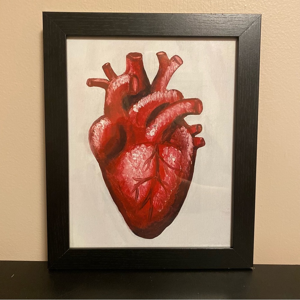 “Aching Heart” Original Framed Art Print